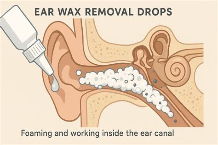 Best Ear Wax Removal Drops: A Comprehensive Guide for Safe and Effective Ear Care