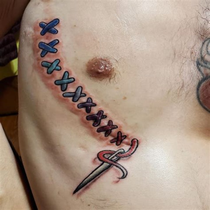 Empowering Scars: Transforming Trauma into Body Art