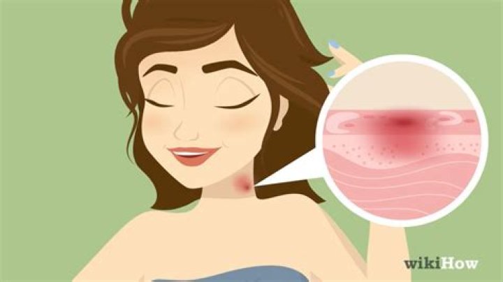 Revealing the Art of Self-Hickeying: Step-by-Step Guide