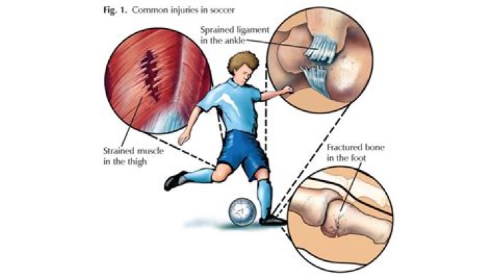 Understanding and Preventing the Most Severe Soccer Injuries